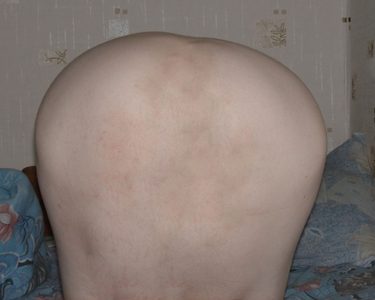 Zhopa.jpg